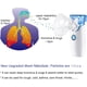 thumbnail image 2 of Nebulizador de tos de malla portátil, inhalador de vapor personal de mano para senos nasales fríos, uso para niños y adultos (batería no incluida)., 2 of 5