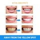 thumbnail image 5 of Instant Tooth Whitening Gel Pen White Teeth Clean Gel Uv Bleach Dental Strength--3pcs, 5 of 5