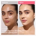 thumbnail image 3 of Nutralessece Facial Serum Set: 10% Niacinamide 4% Tranexamic Acid Alpha Arbutin for Dark Spots, Even Skin Tone; 12% Vitamin C with Ferulic Acid for Eye Wrinkles, Neck Wrinkles, Salon-Quality, 30mL *2, 3 of 14