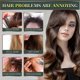 thumbnail image 4 of 2pcs Hair Regrow 7 Day, Ginger Germinal Essential Oil Hair Growth Hair Loss Treatment Hair Care Hair Growth Serum For Men Women 30ml, 4 of 5