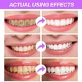 thumbnail image 4 of Hgesaa Decontamination And Whitening Toothpaste Antis Bleeding Gums Fruit Toothpaste Fresh Breath Remove Smoke Stains Plaque Whiten Teeth, 4 of 9