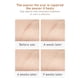 thumbnail image 5 of Crema de eliminación de cicatrices de acné LANBENA contra la eliminación de cicatrices de puntos negros Labymos Crema para eliminar cicatrices, 5 of 7
