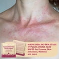 thumbnail image 3 of Toallitas con ácido hipocloroso BASE LABORATORIES para rostro y piel 75, 3 of 9