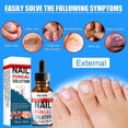 thumbnail image 5 of Nail Fungal Solution, Extra Strong Toenail Fungus Nail Treatment, Fungus Fingernail & Toenail Solution To Renew Damaged Discoloured Toenail, 5 of 5