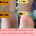 thumbnail image 2 of Crema Antigrietas Para Manos Y Pies, Crema Para Piel Seca Y Agrietada, Pomada Exfoliante Para Talones Agrietados, 2 of 8