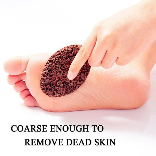 Natural ways to remove dead skin shop from feet