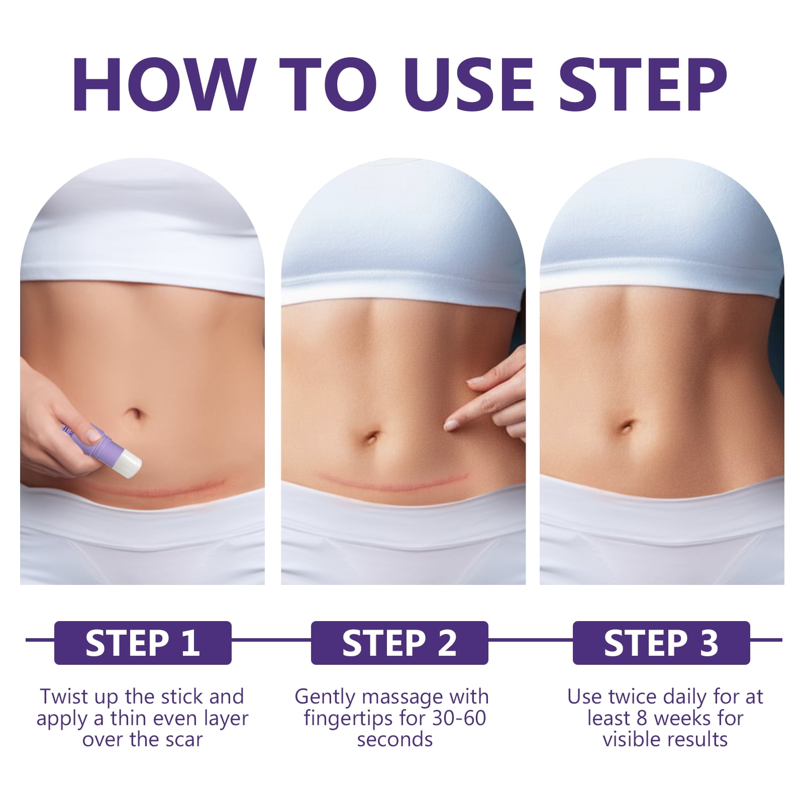 Keloid Bump Removal, Silicone Scar Gel for Keloid Scar Treatment, Acne Scar Treatment, and Scar Cream for Surgical Scars