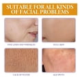 thumbnail image 4 of Aceite esencial de vitamina E que hidrata profundamente la piel y reduce la pérdida de agua, manteniendo la piel suave. 30 ml., 4 of 5