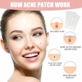 thumbnail image 3 of Parches para espinillas, puntos de parche para zit facial, pegatinas para cubrir imperfecciones, parche absorbente para acné, parche invisible para manchas hidrocoloides, impermeable y trans, 3 of 5