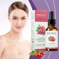 thumbnail image 2 of Xihbxyly Aceite de Rosa Mosqueta, Hidratante Facial, Revitalizante, Tono Uniforme, Usos Múltiples, Aromaterapia y Relajación, 30 Ml para Todo Tipo de Piel, 2 of 7
