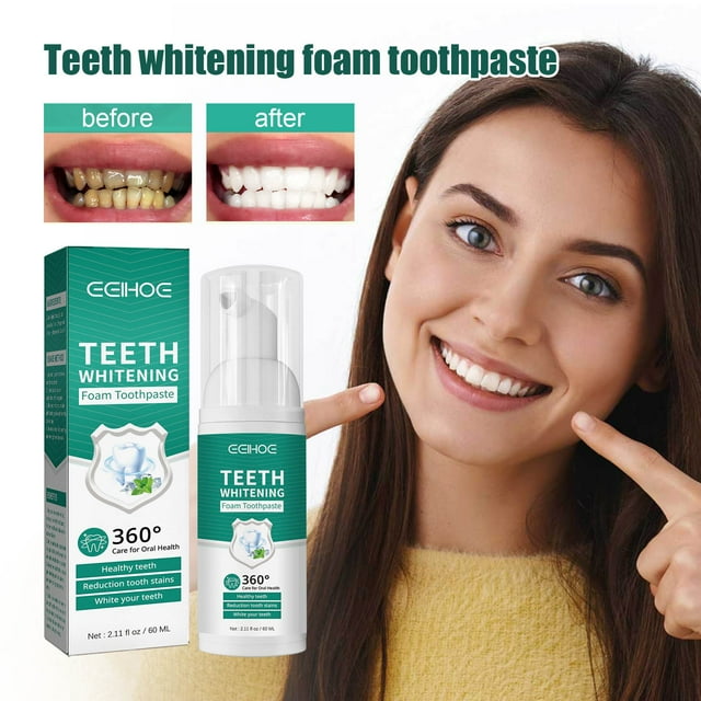 Fiudx Pasta Dental Blanqueadora, Gel Quitamamanchas para Una Sonrisa Radiante, Corrector de Tono Amarillo y Alien Fresco, Cuidado Bucal Diario, Uso para Dientes Sensibles, Tamaño de Viaje de 60 Ml