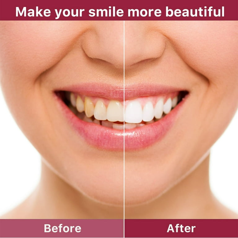 Sp-4 Toothpaste, SP-4 Brightening & Stain Removing Toothpaste