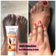 thumbnail image 5 of Suero blanqueador rápido para nudillos oscuros, crema antigrietas, correctores de pigmentación para piel negra, productos para eliminar manchas intensas, 5 of 5