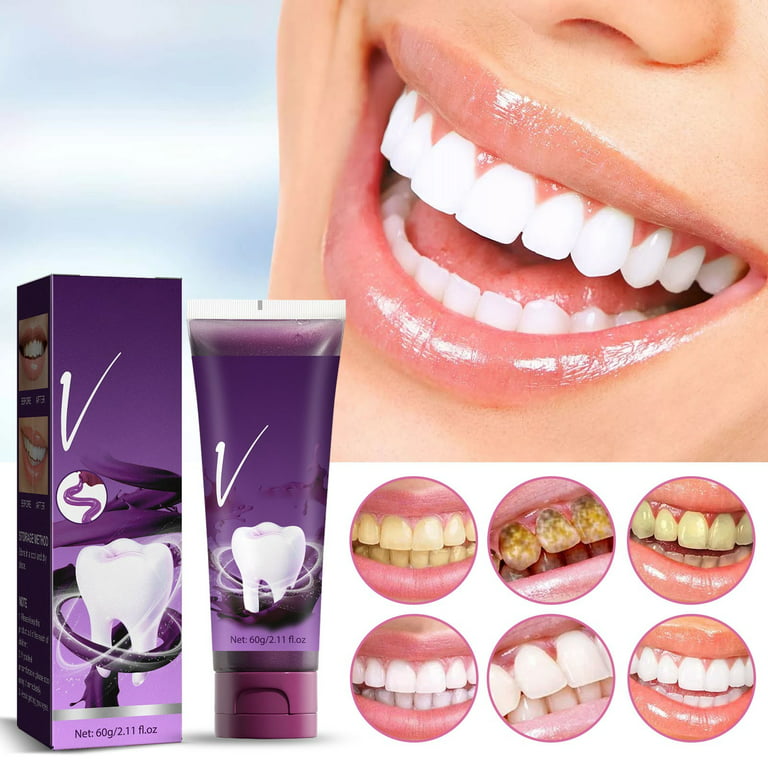  1PCS Brightening Toothpaste to Yellow Stains White Teeth Clean  Mouth Fresh Toothpaste Tooth Stains Yellow Teeth Bad Cavity Filler for Teeth  : Health & Household