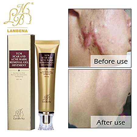 Scar & Acne Mark Removal Gel Ointment help to remove cuts & operation mark (Best Ointment For Scar Removal)