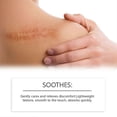thumbnail image 4 of Keloid Bumps Removal Gel, Advanced Scar Gel for Face & Body, Scar Gel for All Scars & Keloids, 4 of 5