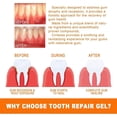 thumbnail image 4 of Gum Repair Treatment Ampoules, Dental Pain Relief Gum Regrowth Essence, Natural Gum Restore Ampoule Teeth Whiteners Mouthwash--7pcs x 1.5ml, 4 of 5