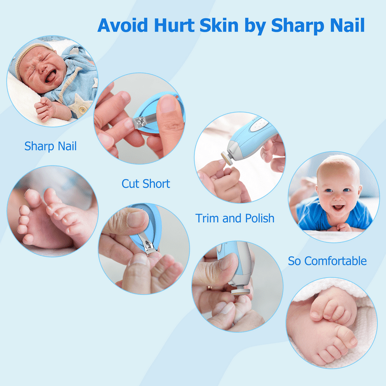 Cut baby skin store with nail clippers