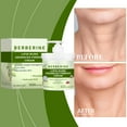 thumbnail image 4 of Crema reafirmante y reductora de arrugas avanzada Xihbxyly 100 g, 4 of 7