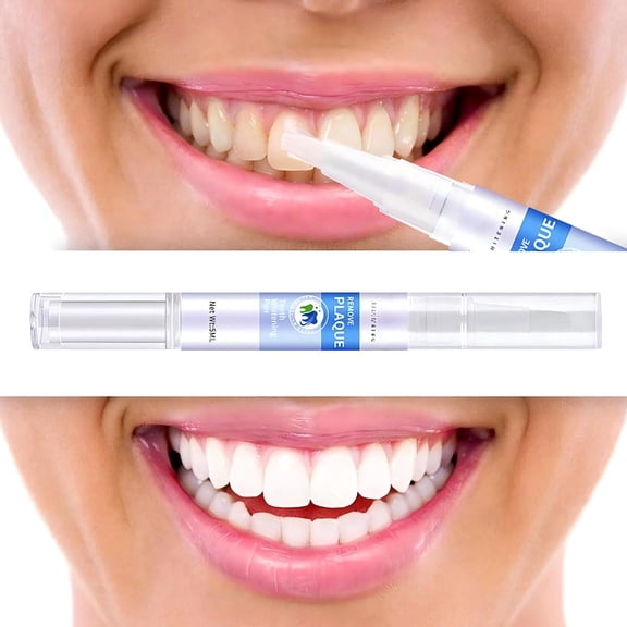 Teeth Whitening Pen 5ml,Portable Gel Pen for Stain Removal from Coffee & Tea,Gentle Peroxide Formula with Mint Flavor,Easy-Apply for At-Home Teeth Whitening,Freshens Breath
