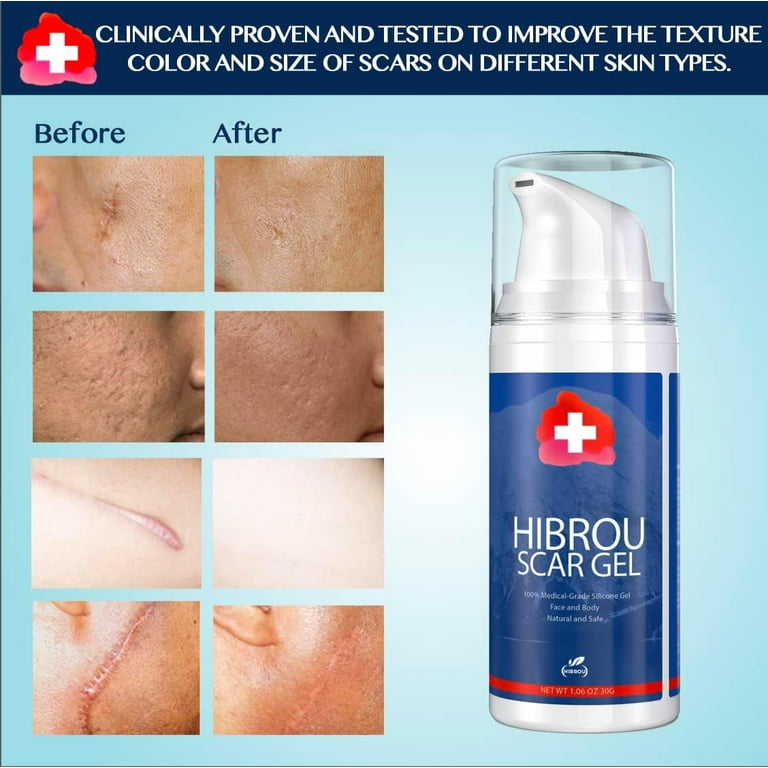 脱毛・除毛 EPI PHOTO SKIN CARE HIGH GRADE MUSEE COSME HOW TO GUIDE