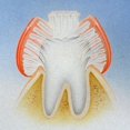 thumbnail image 5 of 4 cepillos de dientes de 3 caras para autismo, cepillo de dientes de viaje de tres cerdas para un cuidado completo de los dientes y las encías, cerdas de gran ángulo que limpian cada diente, suave/suave JM, 5 of 5