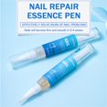 thumbnail image 3 of 1-5PCS 4ml Nail Antifungal Gel Anti-Infection Infected Nail Infection Nail Ringworm Nail, 3 of 5