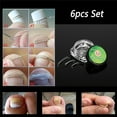 Papaba Toenail Correction Wire,6/12Pcs Ingrown Toenail Correction Wire