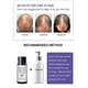 thumbnail image 4 of 1-3PCS Breylee Hair Care Anti-alopecia Essential Oil Hair Care 20ml, 4 of 5