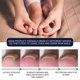 thumbnail image 5 of Toenail Nail Fungus Treatment Repair Fingernail Device Toenail Treatment for Foot Nail Fungus Essential Oil Onychomycosis Care, 5 of 5