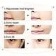 thumbnail image 5 of Limpiadores faciales HUOGUO 7 en 1 de radiofrecuencia EMS Pink, 5 of 5