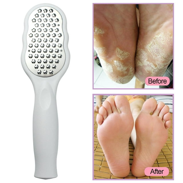 Removedor De Callos Baoblaze Para Pies De Acero Inoxidable Placa Grande Profesional Blanco