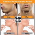 thumbnail image 3 of 2 uds Jawline ejercitador para hombres y mujeres, eliminador reductor de mentón doble de silicona Aespa kaili Sencillez, 3 of 5
