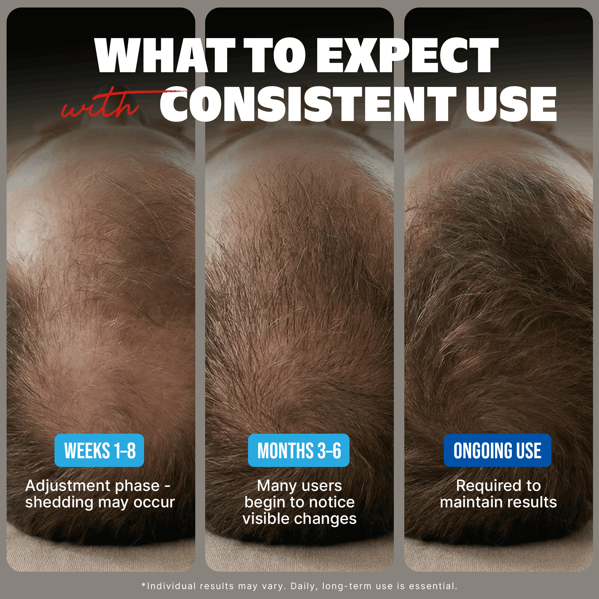 Kirkland Minoxidil 5% for Men, Topical Solution Extra Strength Hair Regrowth Treatment, 6 Months Supply, Total 12 Fl Oz, Premium Dropper Applicator, Exclusive Comb and Bonus Free Guide Included