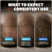 Kirkland Minoxidil 5% for Men, Topical Solution Extra Strength Hair Regrowth Treatment, 6 Months Supply, Total 12 Fl Oz, Premium Dropper Applicator, Exclusive Comb and Bonus Free Guide Included