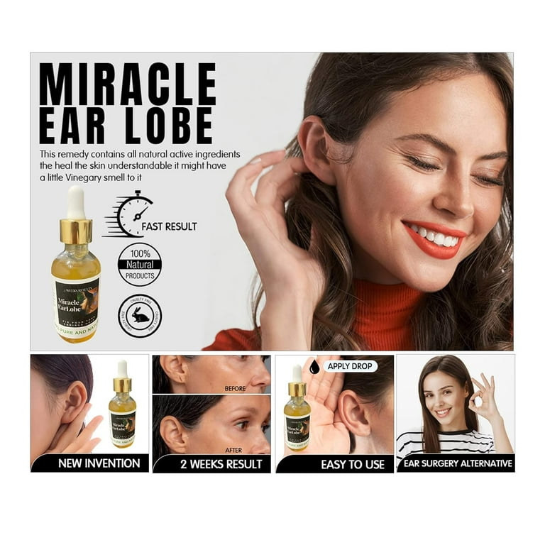 Lobe Wonder 180 Earring Support Patches - 3 Pack 