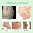 thumbnail image 4 of Clearance & Promo, Exfoliating Foot Spray for Softened Skin and Keratin RemovalHydrating and Softening, 20ml for Smoother Feet, Daily Foot Care Solution, Ideal for Callus Reduction | Plastic, B, 4 of 7