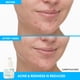 thumbnail image 5 of Serum innisfree, tratamiento suave con retinol salicílico para el acné, 50 ml, 5 of 9