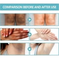 thumbnail image 5 of Crema de tratamiento de terapia de acantosis nigricans, crema reparadora de piel de espina negra, crema hidratante blanqueadora correctora de manchas oscuras, 5 of 5