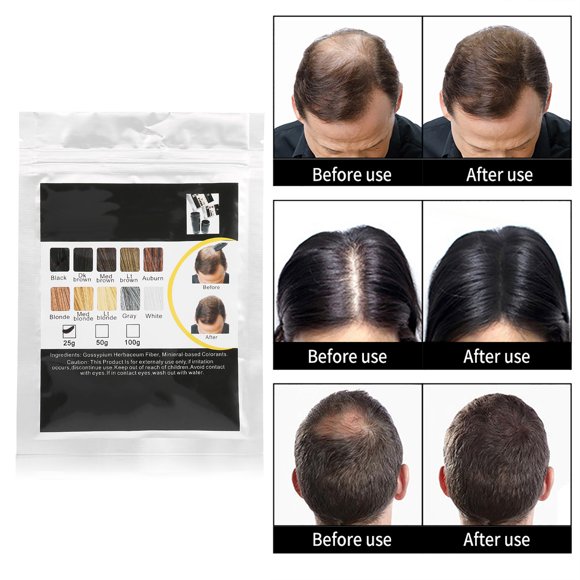Pérdida De Cabello Fibra De Construcción Espesante Para El Cabello Solución Para La Pérdida De Cabello Corrector Cabello Más Negro