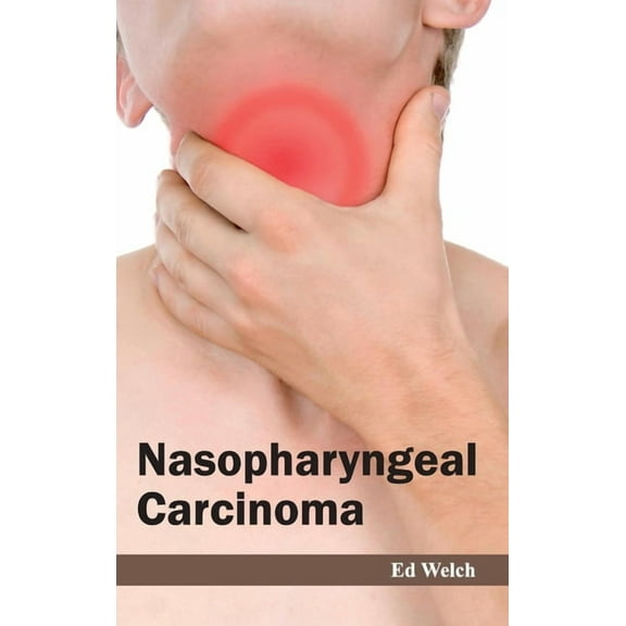 Nasopharyngeal Carcinoma, (Hardcover)