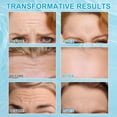 thumbnail image 3 of Yecuce 3-Pack Forehead Wrinkle Patches with Aloe, Collagen, Vitamin E, Anti Wrinkle ,Nourishes for Radiant Skin, 3 of 9