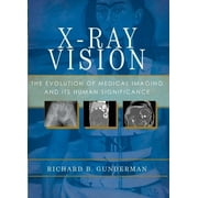 X-Ray Vision : The Evolution of Medical Imaging and Its Human Significance