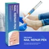 Fungus Treatment Pen, Fungus Stop Pen, Toenail and Nail Care Solution by Neomen, Fixes and Strengthens Discolored and Damaged Nails (2 Pcs)