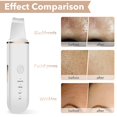 thumbnail image 5 of Espátula de piel, limpiador de poros, herramienta de elevación de belleza, extractor de 4 modos, espátula de limpieza facial Afortunado Sencillez, 5 of 5