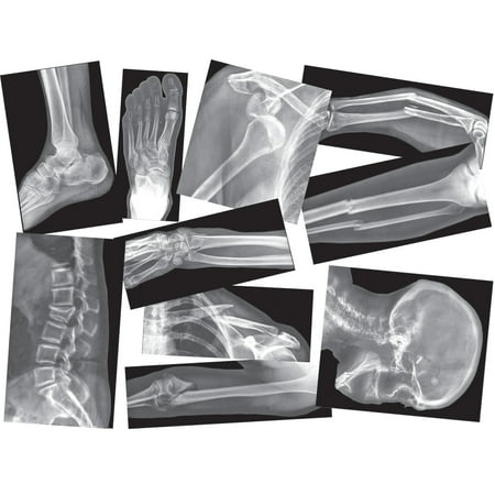 UPC: 0066960059144 | Roylco Broken Bones X-Ray Set Pack of 15
