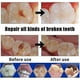 thumbnail image 1 of Pegamento para reparar espacios entre dientes, dientes postizos, kit de relleno dental, pegamento para dientes postizos temporales, 1 of 3