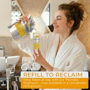 Antifungal Psoriasis Shampoo, Eczema, Shampoo, Seborrheic Dermatitis Shampoo
