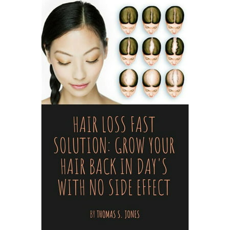 Hair Loss Fast Solution: Grow Your Hair Back In Day's With No Side Effect - (The Best Way To Grow Your Hair)
