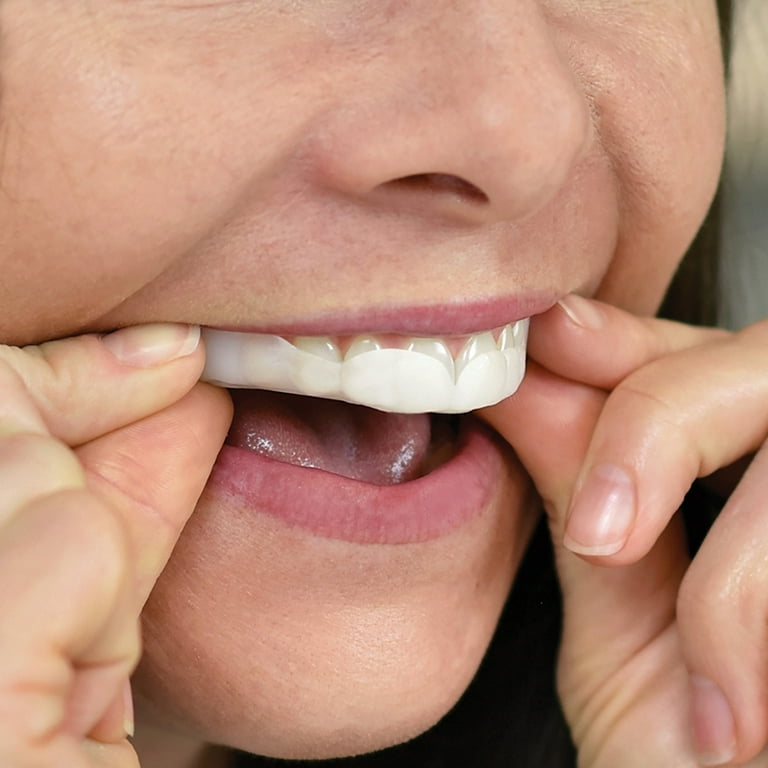 SleepRight ProRx Custom Dental Guard for Nighttime Teeth Grinding, 1 Count